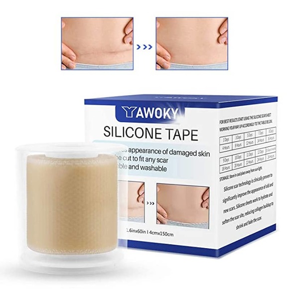 Silicone Scar Sheets (1.6” x 60”Roll-150cm) Scar Tape Reusable, Washable - Picture 1 of 7